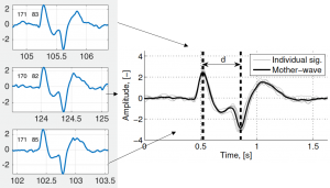 EOG signals, Eye movement