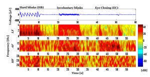 Feature Extraction in Frequency Domain