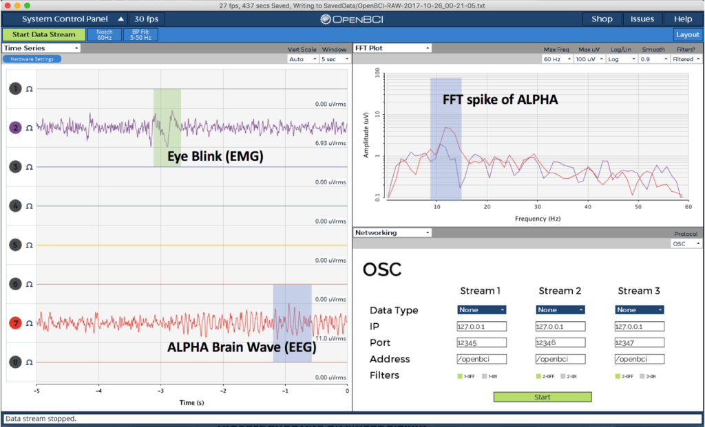 OpenBCI