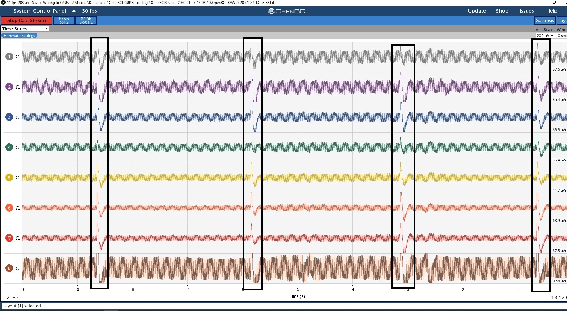 Signal problem — OpenBCI Forum