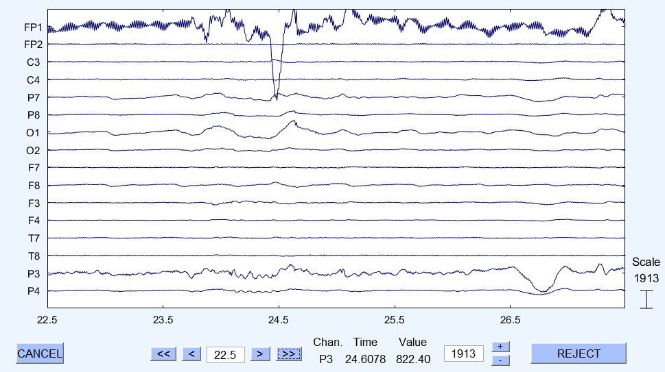 Scroll Channel Data Screenshot